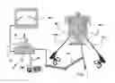Fig. 02 - Device and methods of improving laparoscopic surgery