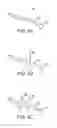 Fig. 11 - Systems and methods for unobstructed visualization and ablation