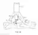 Fig. 13 - Systems and methods for unobstructed visualization and ablation