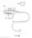 Fig. 16 - Systems and methods for unobstructed visualization and ablation