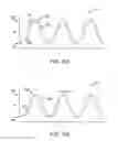 Fig. 18 - Systems and methods for unobstructed visualization and ablation