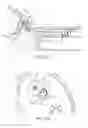 Fig. 19 - Systems and methods for unobstructed visualization and ablation