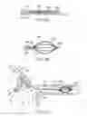Fig. 23 - Systems and methods for unobstructed visualization and ablation