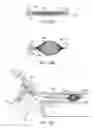 Fig. 24 - Systems and methods for unobstructed visualization and ablation