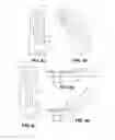 Fig. 04 - TISSUE GRIPPING DEVICE