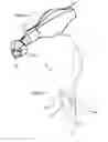 Fig. 07 - ENDOBRONCHIAL TUBE WITH INTEGRATED IMAGE SENSOR