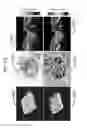 Fig. 20 - QUANTIFICATION OF LOCAL CIRCULATION WITH OCT ANGIOGRAPHY