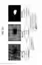 Fig. 22 - QUANTIFICATION OF LOCAL CIRCULATION WITH OCT ANGIOGRAPHY
