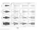 Fig. 11 - Magnetoencephalography source imaging for neurological functionality characterizations