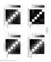 Fig. 12 - Magnetoencephalography source imaging for neurological functionality characterizations