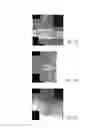Fig. 02 - MR spectroscopy system and method for diagnosing painful and non-painful intervertebral discs