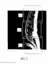 Fig. 03 - MR spectroscopy system and method for diagnosing painful and non-painful intervertebral discs