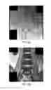 Fig. 05 - MR spectroscopy system and method for diagnosing painful and non-painful intervertebral discs