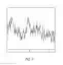 Fig. 07 - MR spectroscopy system and method for diagnosing painful and non-painful intervertebral discs