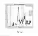 Fig. 13 - MR spectroscopy system and method for diagnosing painful and non-painful intervertebral discs