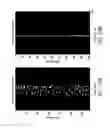 Fig. 24 - MR spectroscopy system and method for diagnosing painful and non-painful intervertebral discs