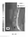 Fig. 41 - MR spectroscopy system and method for diagnosing painful and non-painful intervertebral discs