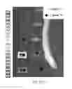 Fig. 42 - MR spectroscopy system and method for diagnosing painful and non-painful intervertebral discs