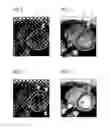 Fig. 03 - Magnetic resonance method and apparatus for determining deformation information from a cyclically moving examination subject