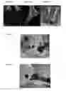Fig. 04 - Feet positioning system for magnetic resonance imaging studies