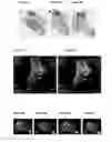 Fig. 05 - Feet positioning system for magnetic resonance imaging studies
