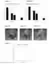 Fig. 06 - Feet positioning system for magnetic resonance imaging studies