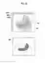 Fig. 22 - Fluorescence observation device, endoscopic system, processor device, and operation method