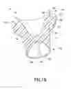 Fig. 14 - Capillary action collection device and container assembly