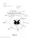 Fig. 08 - Spinal cord stimulation guidance system and method of use