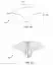 Fig. 16 - Spinal cord stimulation guidance system and method of use