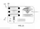 Fig. 20 - Spinal cord stimulation guidance system and method of use