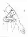 Fig. 02 - Micro vein enhancer for hands-free imaging for a venipuncture procedure