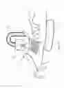 Fig. 12 - Micro vein enhancer for hands-free imaging for a venipuncture procedure