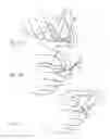 Fig. 26 - Micro vein enhancer for hands-free imaging for a venipuncture procedure