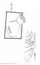 Fig. 37 - Micro vein enhancer for hands-free imaging for a venipuncture procedure
