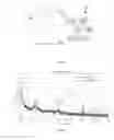 Fig. 06 - HEADSET FOR BIO-SIGNALS ACQUISITION