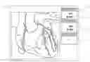 Fig. 01 - Automated identification and classification of intravascular lesions