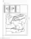 Fig. 07 - Automated identification and classification of intravascular lesions