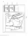 Fig. 08 - Automated identification and classification of intravascular lesions