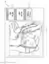 Fig. 09 - Automated identification and classification of intravascular lesions