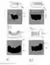 Fig. 03 - Method for capturing a three-dimensional x-ray image