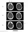Fig. 06 - Systems and methods for diagnosing strokes