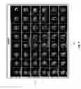 Fig. 09 - INTERACTIVE PHYSIOLOGIC DATA AND INTRAVASCULAR IMAGING DATA AND ASSOCIATED DEVICES, SYSTEMS AND METHODS