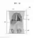 Fig. 12 - Apparatus and method of processing medical image