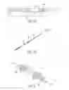 Fig. 02 - Devices and methods for occluding or promoting fluid flow