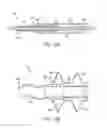 Fig. 09 - Devices and methods for occluding or promoting fluid flow