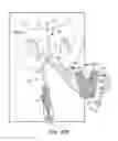 Fig. 24 - Tissue anchor