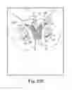 Fig. 27 - Tissue anchor