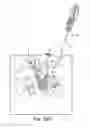 Fig. 28 - Tissue anchor