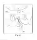 Fig. 53 - Tissue anchor